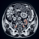 МРТ органів малого тазу